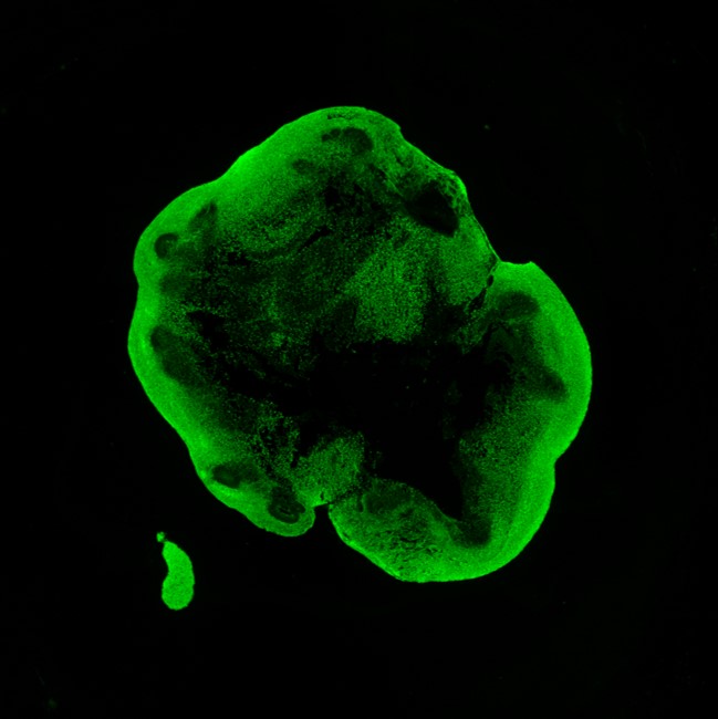Green fluorescent irregular cell-like cluster on a black background (fluorescence microscopy).